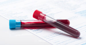 functional medicine lab work blood tests