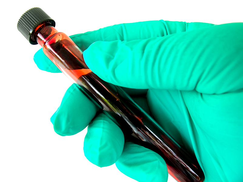 Avoid afternoon thyroid test